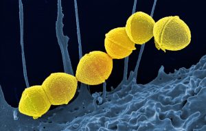 Group A strep virus cells